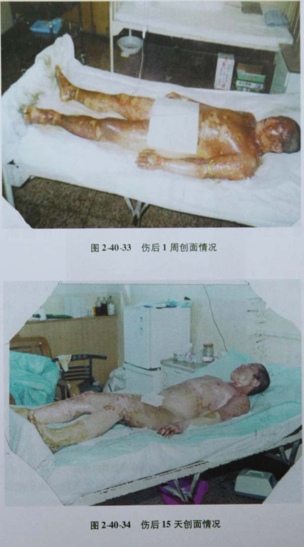 201134104010336